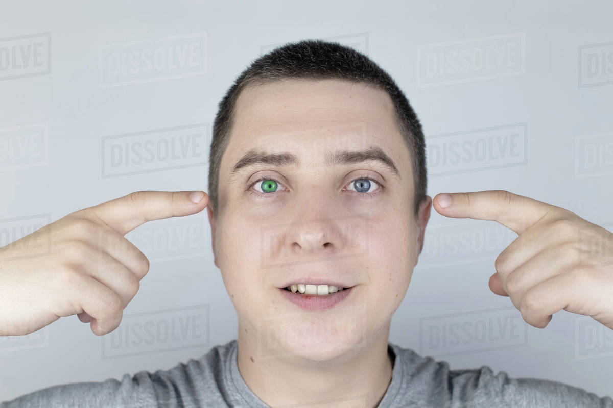 A man with different color eyes looks into the frame. The right eye is