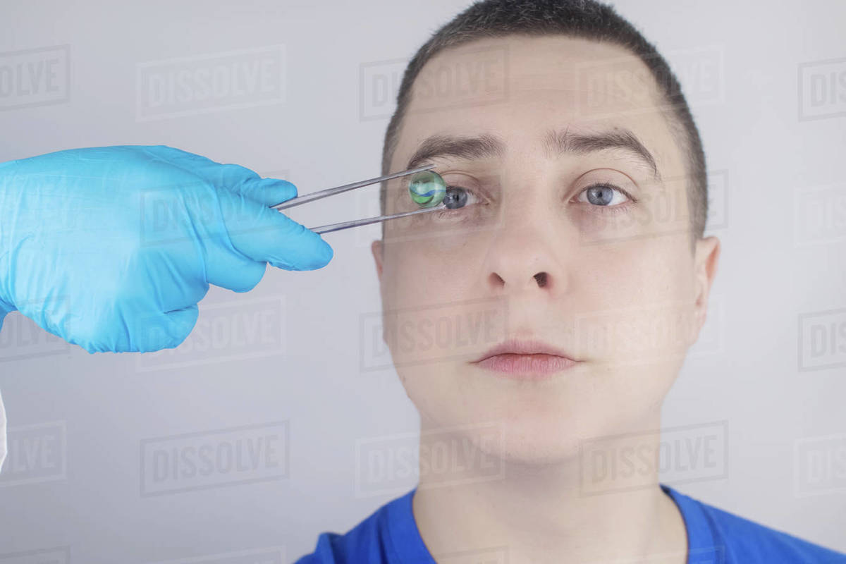 Conceptual shot of an eye crystalline lens replacement. Ophthalmic