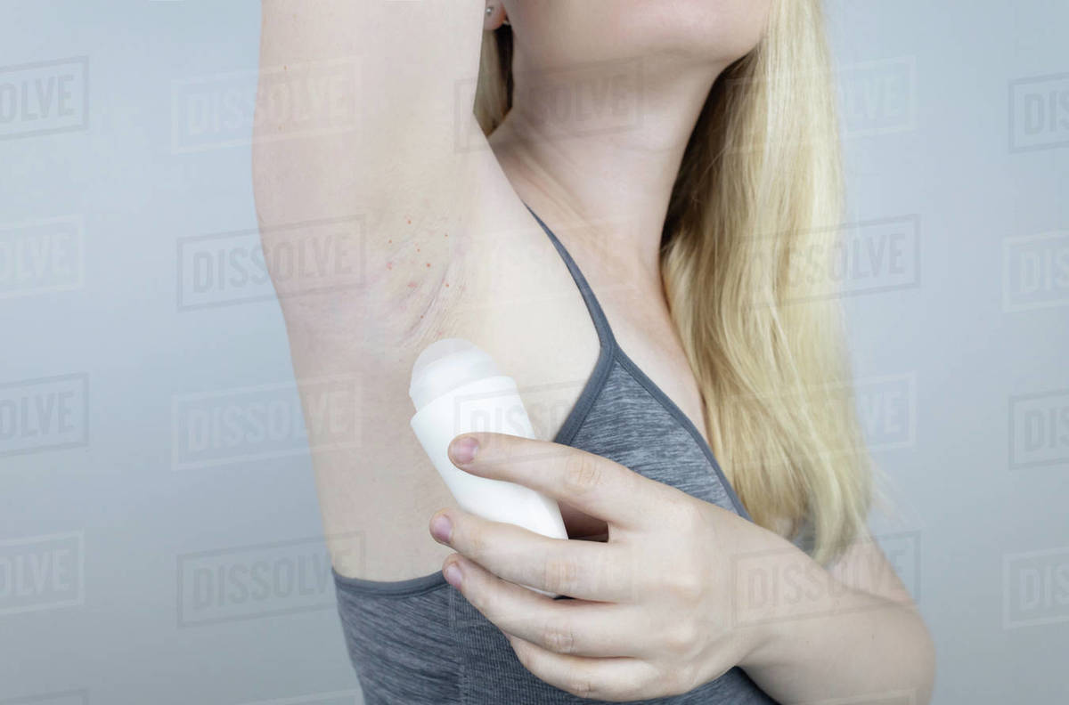 Armpit rash. Underarm skin irritation. Blonde girl shows irritation on