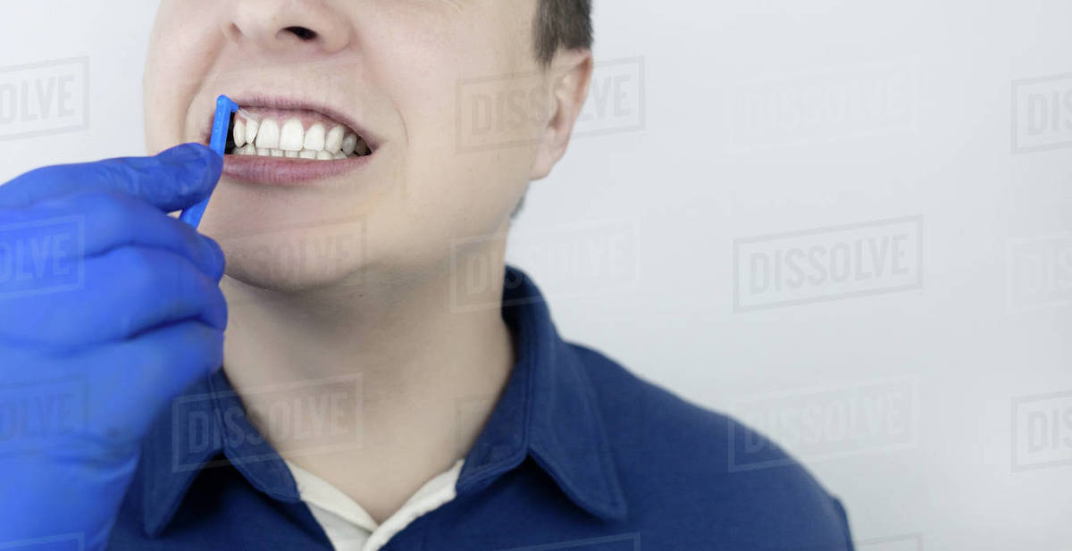 Interdental brush. A man shows a brush for cleaning the interdental space. Brush for cleaning